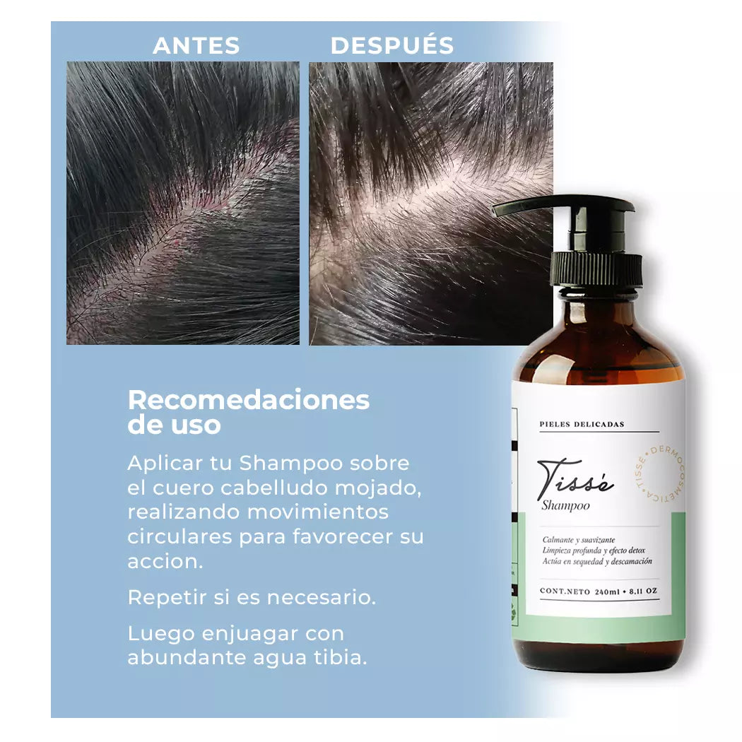 Shampoo Pieles Delicadas