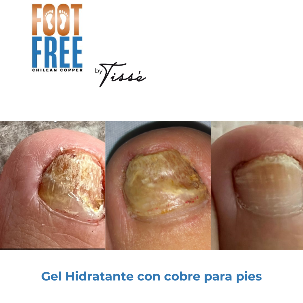 Foot Free Gel hidratante para pies