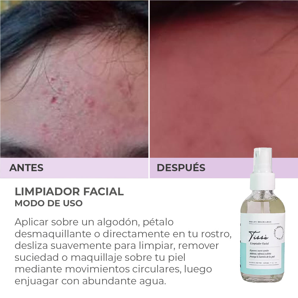 Limpiador Facial