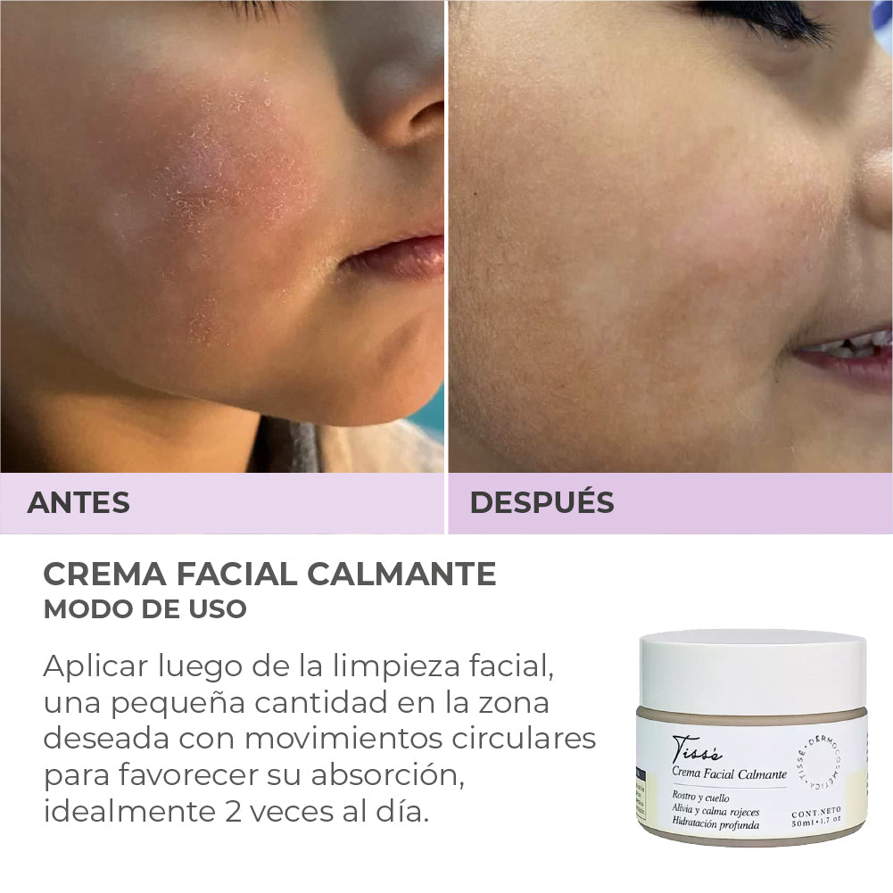 Crema Facial Calmante