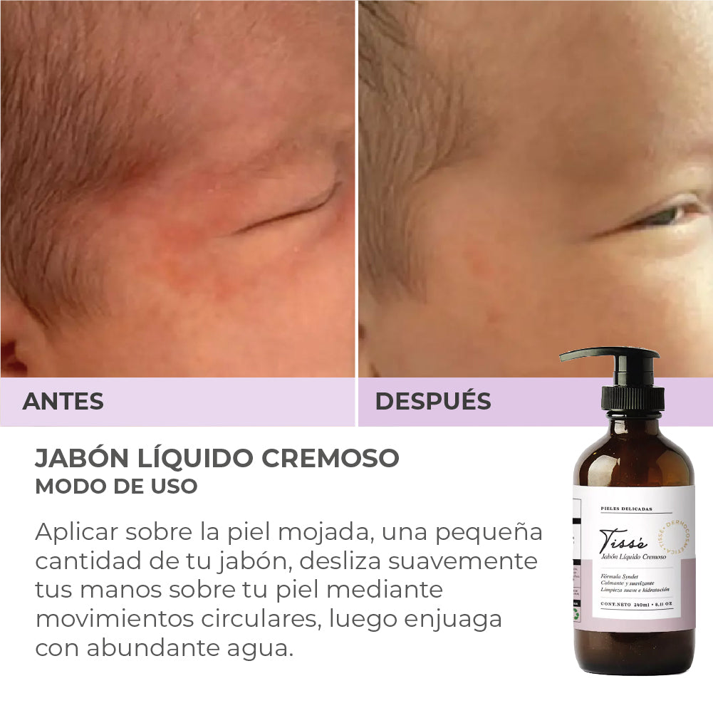 Jabón Pieles Delicadas