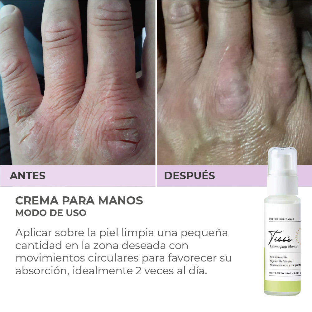 Crema para Manos