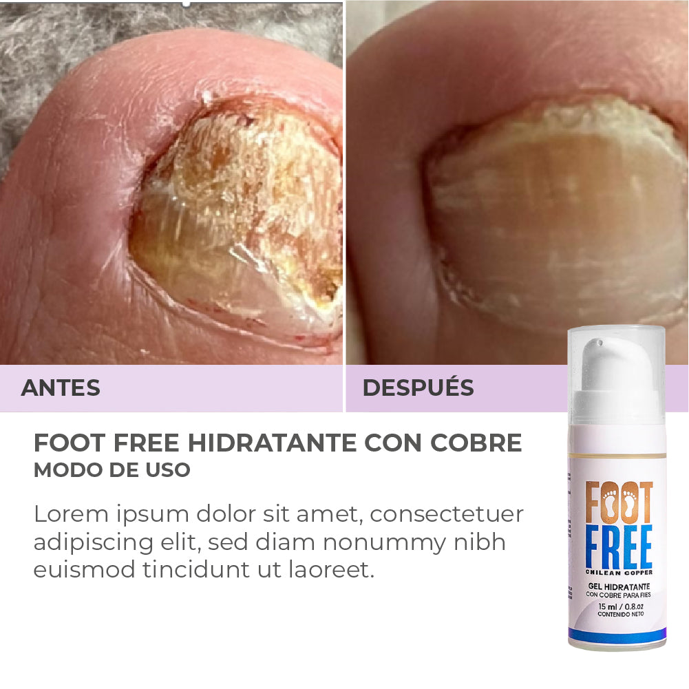 Foot Free Gel hidratante para pies