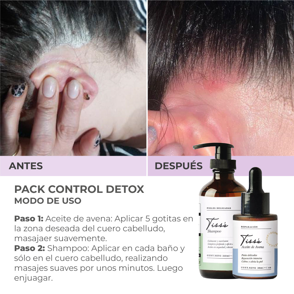 Pack Control Detox