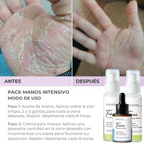 Pack Manos Intensivo🥇