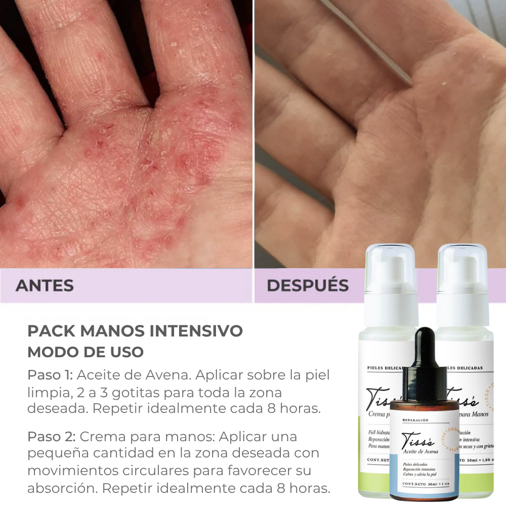 Pack Manos Intensivo🥇