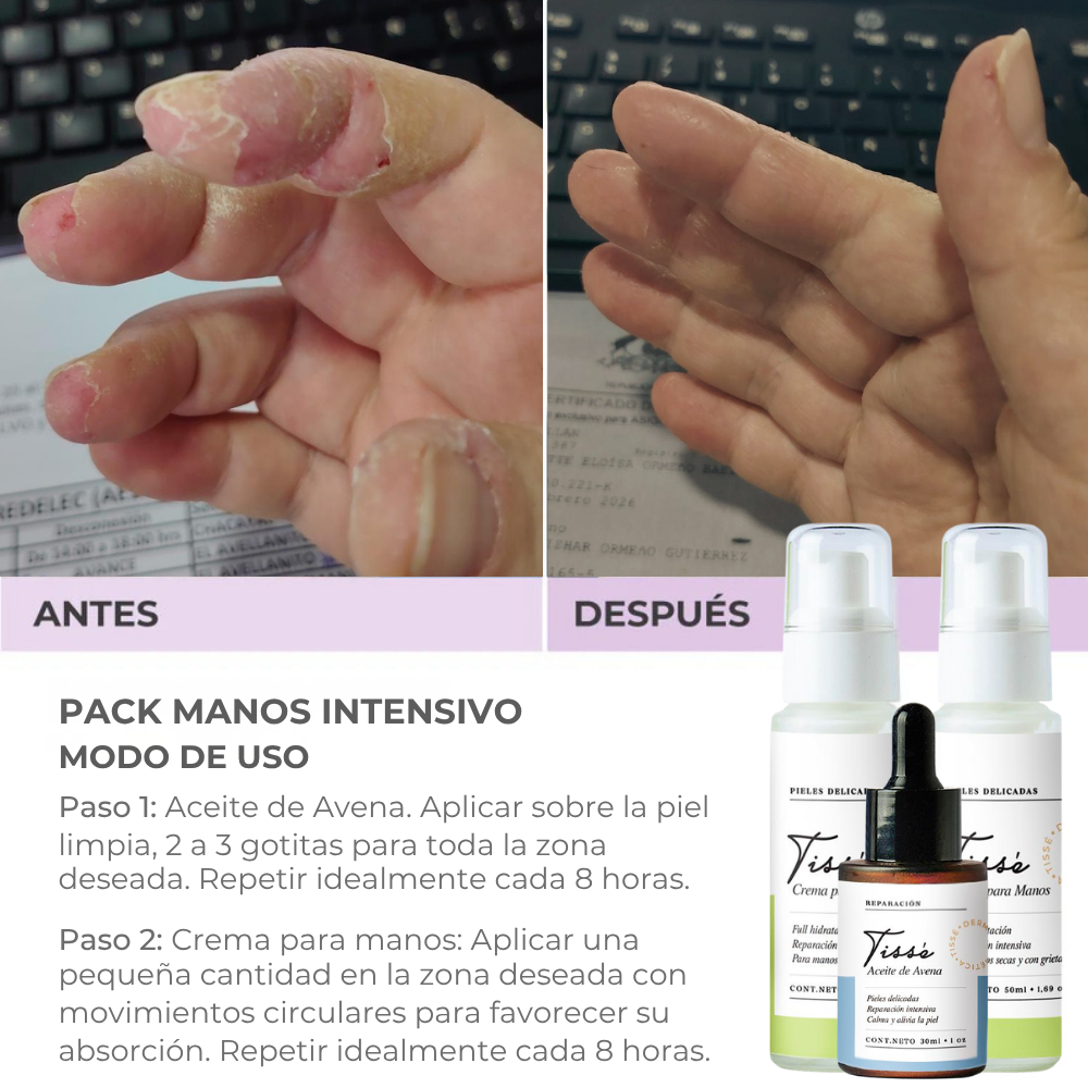 Pack Manos Intensivo🥇